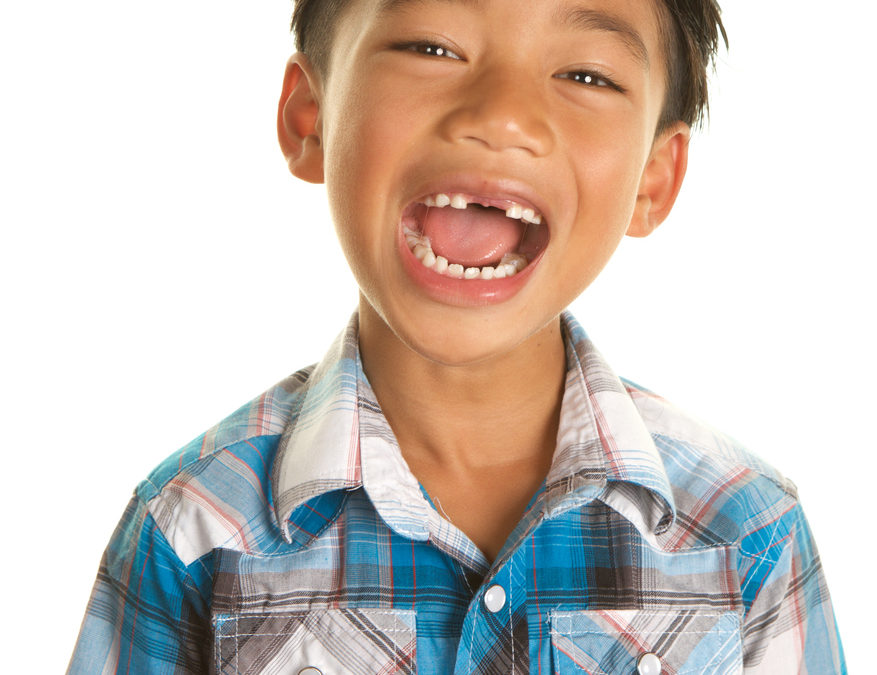 Excited Filipino Boy on White Background Missing Two front Teeth